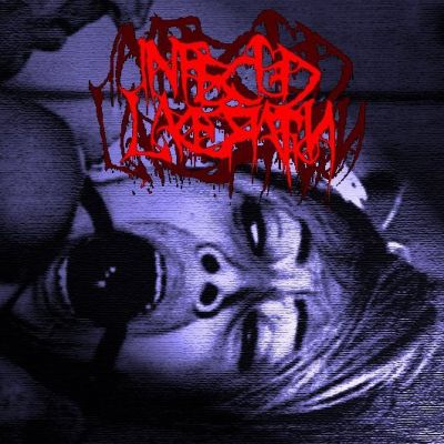 Infected Laceration - Infected Laceration