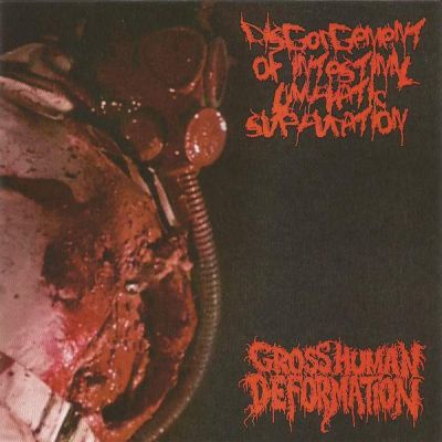 Disgorgement of Intestinal Lymphatic Suppuration - Disgorgement of Intestinal Lymphatic Suppuration / Gross Human Deformation