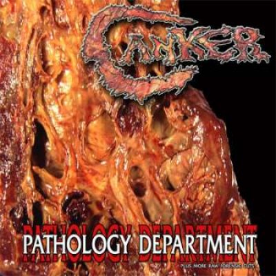 Canker - Pathology Department