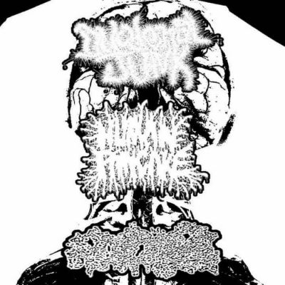 Seborrheic Keratosis - Disembodied