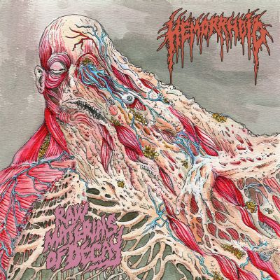 Hemorrhoid - Raw Materials of Decay