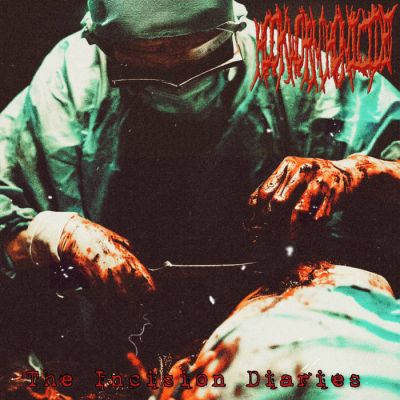 Hookworm Homicide - The Incision Diaries