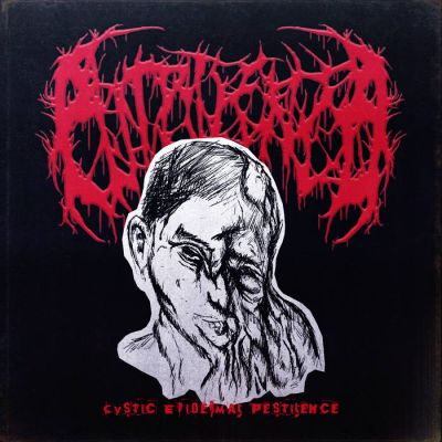 Putrilence - Cystic Epidermal Pestilence