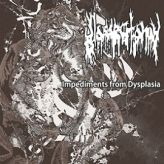 Glossectomy - Impediments from Dysplasia cover art