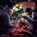 Cryogenical Excision - Micro Surgery cover art